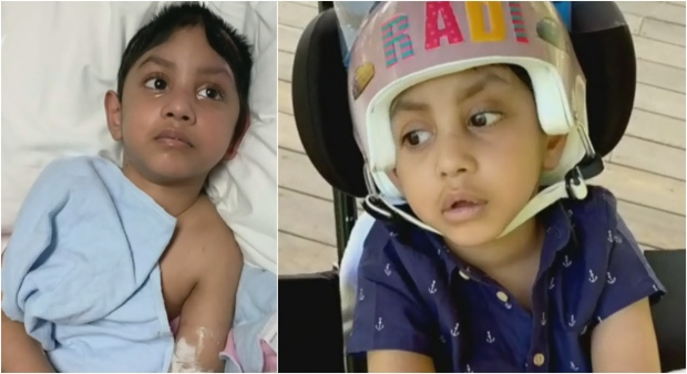 Child injured in alleged hit-and-run now opening his eyes
