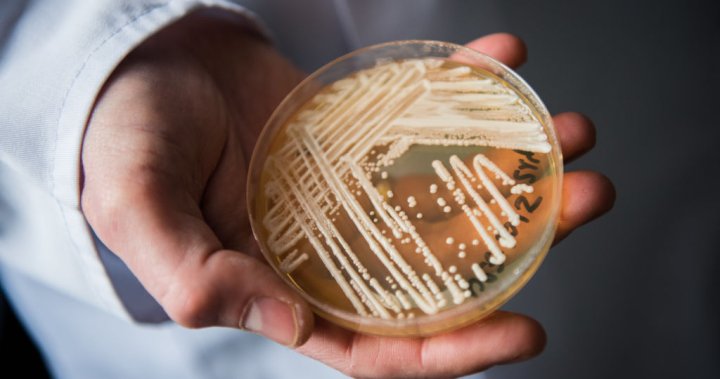 ‘Worsening spread’ of deadly fungal infection raising alarm in U.S. – National
