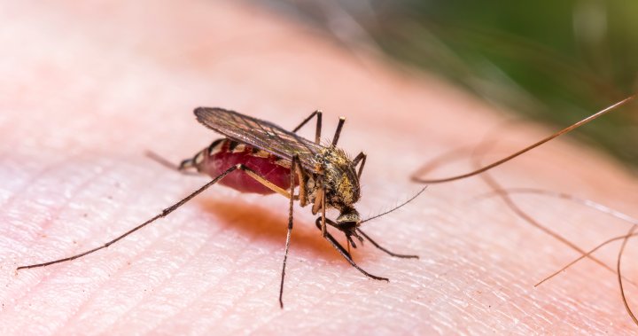 Are you a mosquito magnet? The science behind why some people get more bites – National