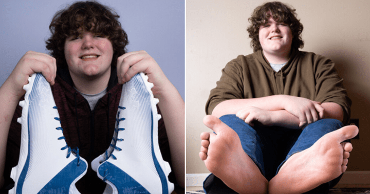 Teen who desperately needed size 23 shoes now holds 2 world records – National